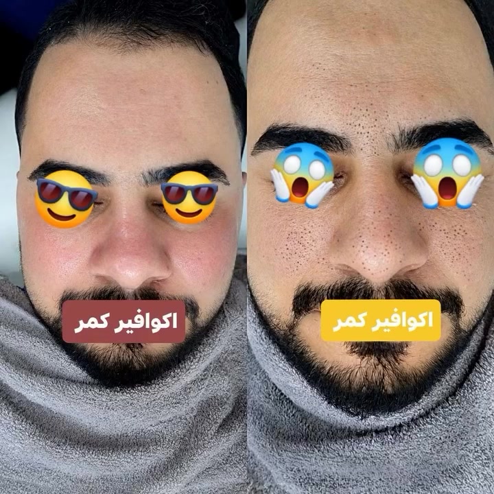 لحد يتحداني الأول اني و الكل بالأخير 🤫 
للحجز مراسلة الصفحه
واتساب ***********
واتساب ***********
