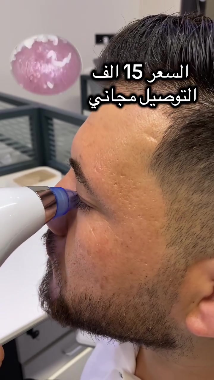 ودّعي الرؤوس السوداء وتراكم الدهون!

جهاز تنظيف المسام يساعدچ تنظفين بشرتچ بعمق من الأوساخ والزيوت والرؤوس السوداء، بدون الحاجة للعصر باليد �

واتساب ***********
#شفط_الدهون #بيع_وشراء #كهربائي #بيع #جهاز
