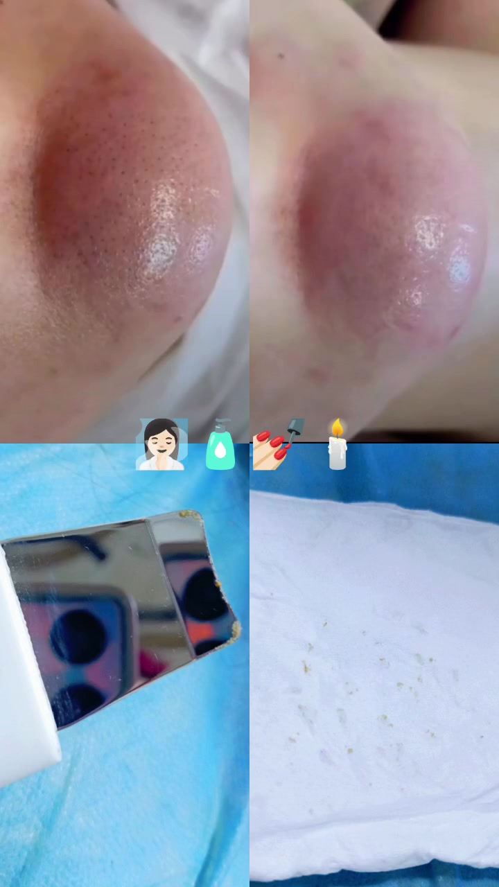 سنتر ورد للتجميل ✨ 

تنظيف بشره عميق هايدروفيشل ✨

العنوان.طويريج حي الشهداء قرب قاعه روز 📍 

للحجز .دايركت📱 او الاتصال (***********)📞

#صالون  #سنتر #اكسبلور_فولو #طويريج #متابعين
