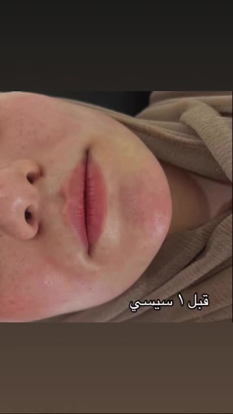 البساطة الها جمالها فلر شفة ايطالي
للتواصل***********
