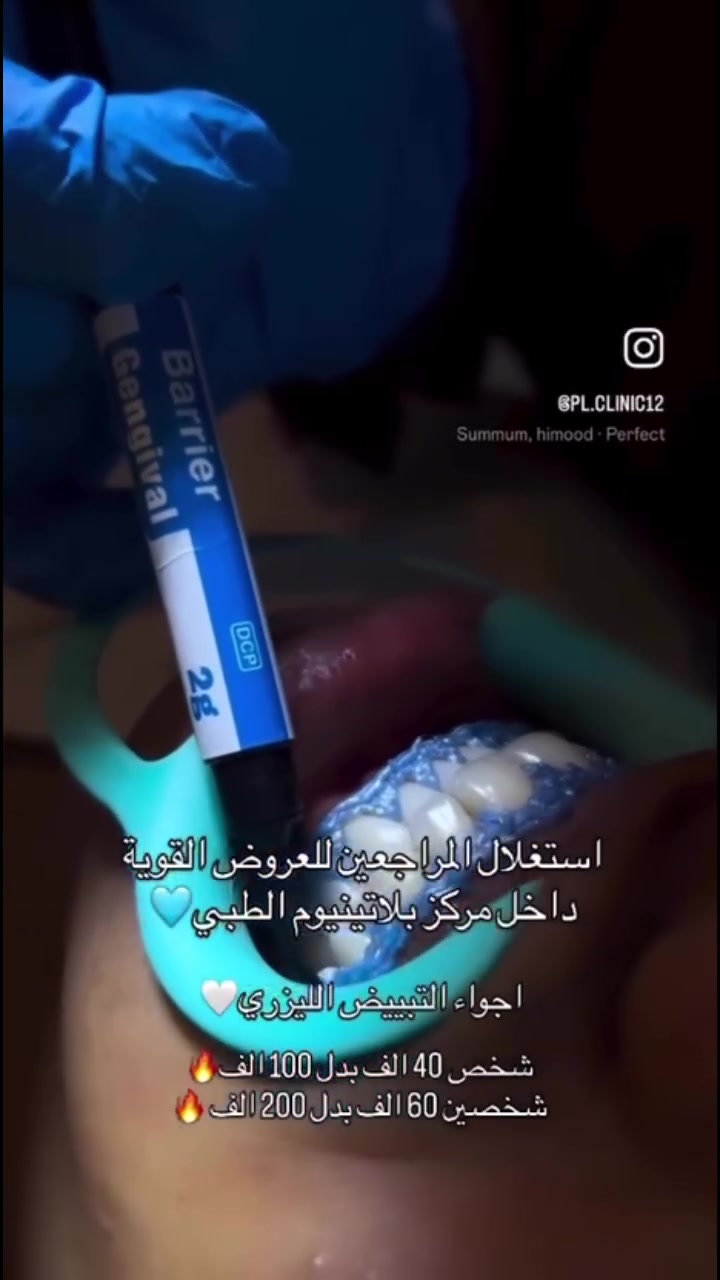 عرض للتبييض الليزري 💕
