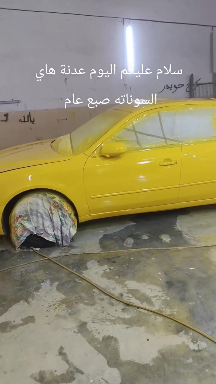 سلام عليكم اليوم عدنة هاي السوناته صبع عام قبل وبعد العمل اتصال ***********
