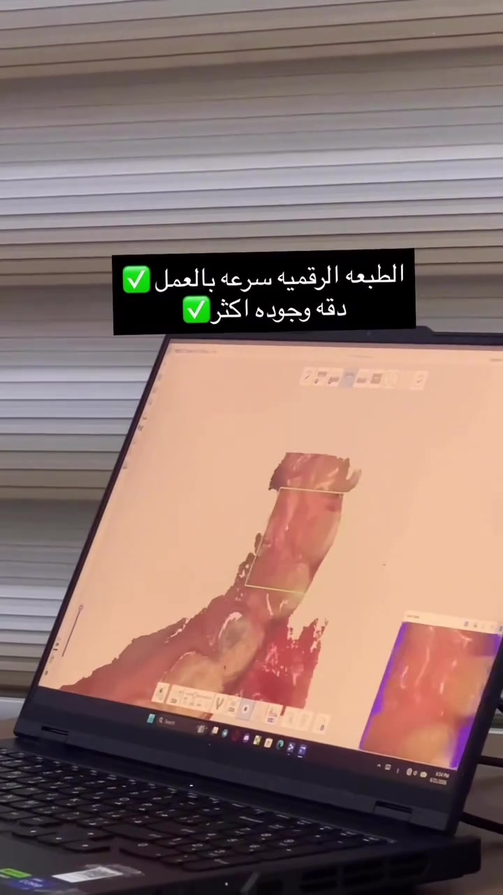 طباعة رقمية • طب الأسنان • نجف ملحق الروان