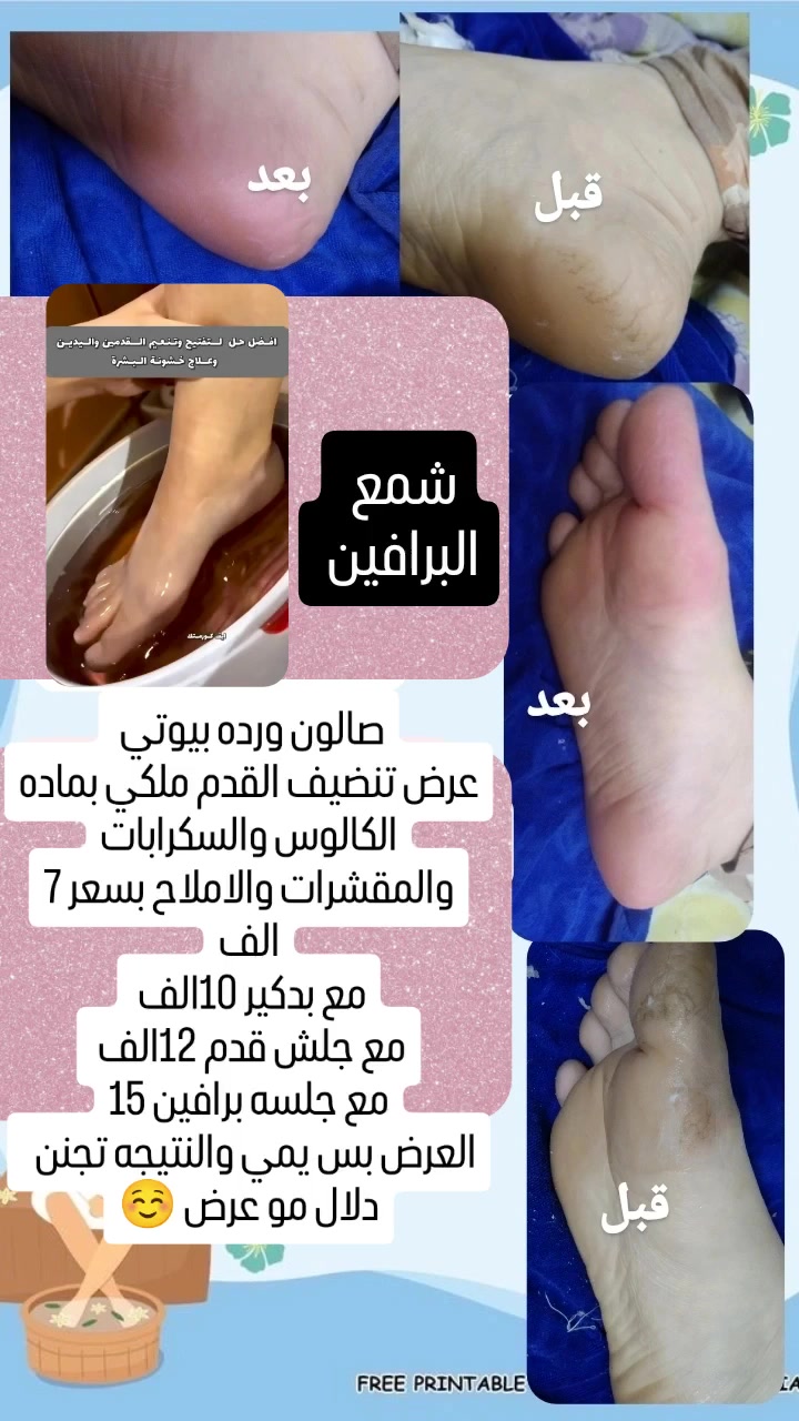 𝒲𝒶𝓇𝒹𝒶 𝐵𝑒𝒶𝓊𝓉𝓎 🎀 
🌷 ورده بيوتي 🌷 
الخطيب الزراعي شارع المولده الحمره شارع عيادات صحتي 
للحجز مراسله الصفحه الرئيسيه 
او مراسله الرقم واتساب ***********
#شعب_صيني_ماله_حل😂❤️‍🩹فولو #فولومي #فولورز #اكسبلور_فولو #ضيفوني #الاكسبلور_فولو💕 #لايك_مي #بيع_لايكات #لايكاتكم_تسعدني #لايك_كومنت #تعليقات #تعليقاتكم_تسعدني😍 #تعليق #تعليقاتكم_تسعدني #متابعة_للبيج #ضيفو #اكسبلور #لقطة #لايك #دعم #تفاعل #لايكات #كومنت #كومنتات #اكسبلور
