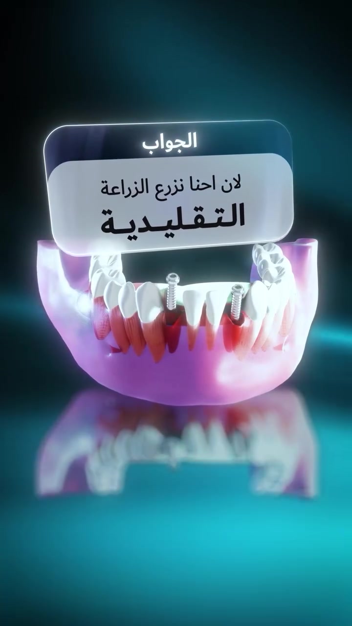 عيادة بسماية • زرعات تقليدية • بغداد