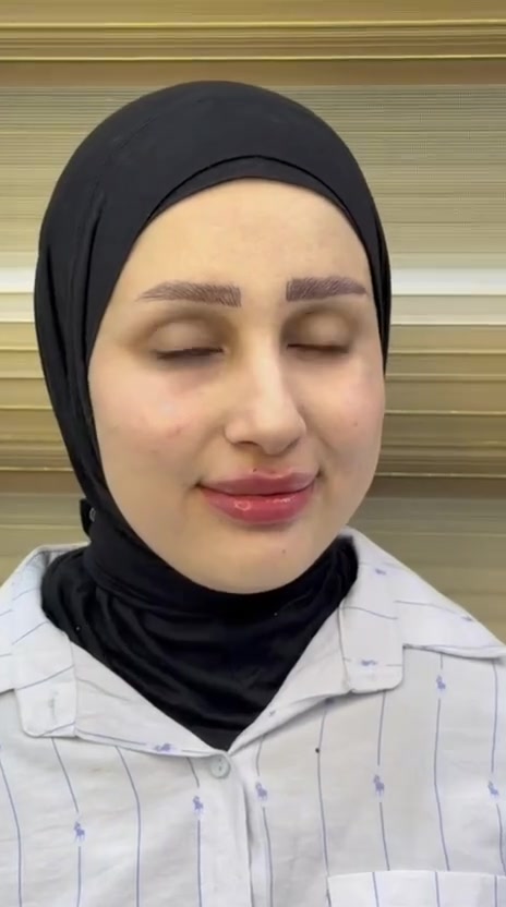 عيادة مون لايت • د ضحى حسين • تغيير شامل