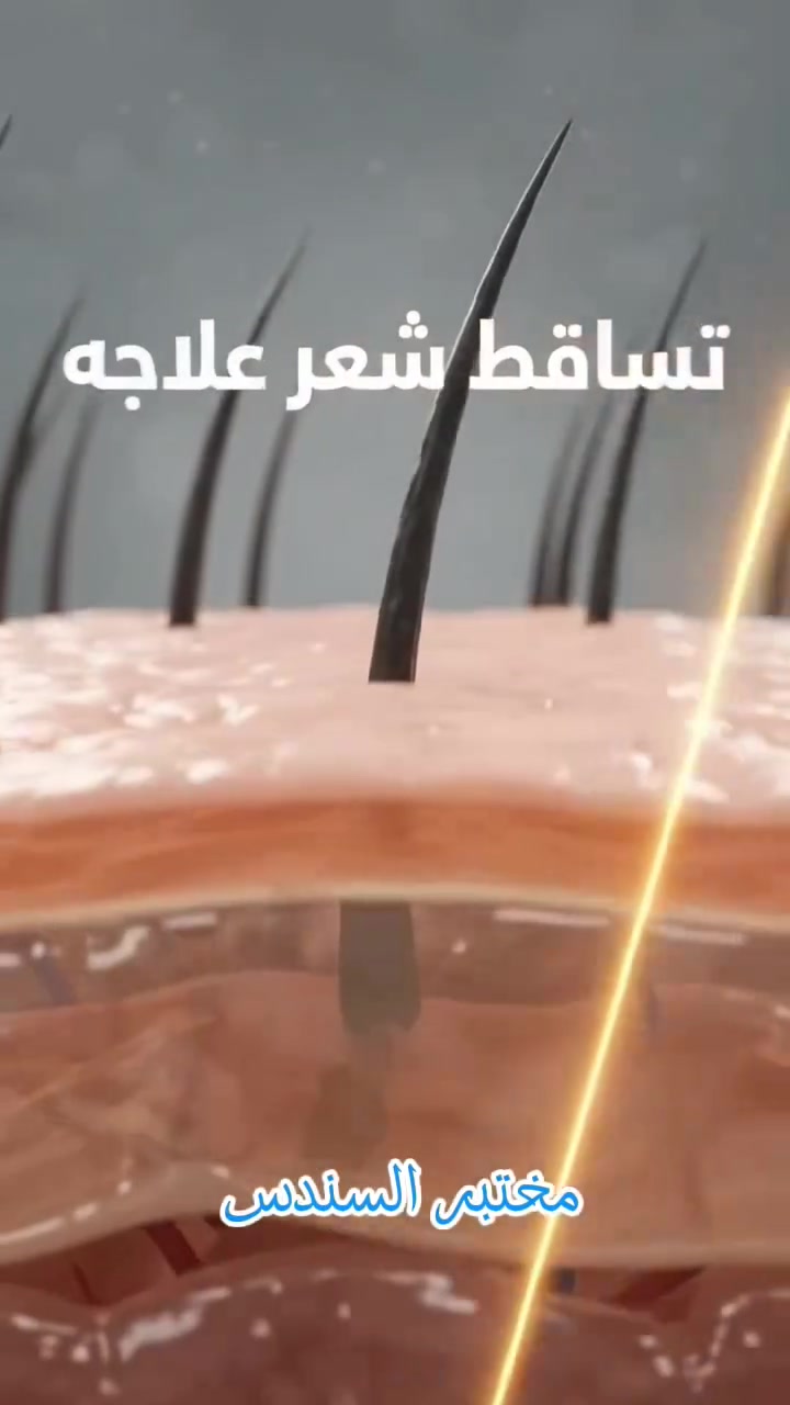 فحوصات شعر • مختبر السندس • الميكانيك