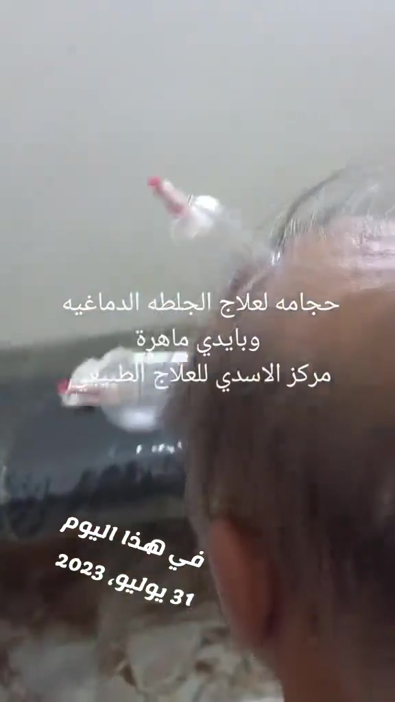 علاج الجلطه الدماغيه • الغزاليه • شارع البداله