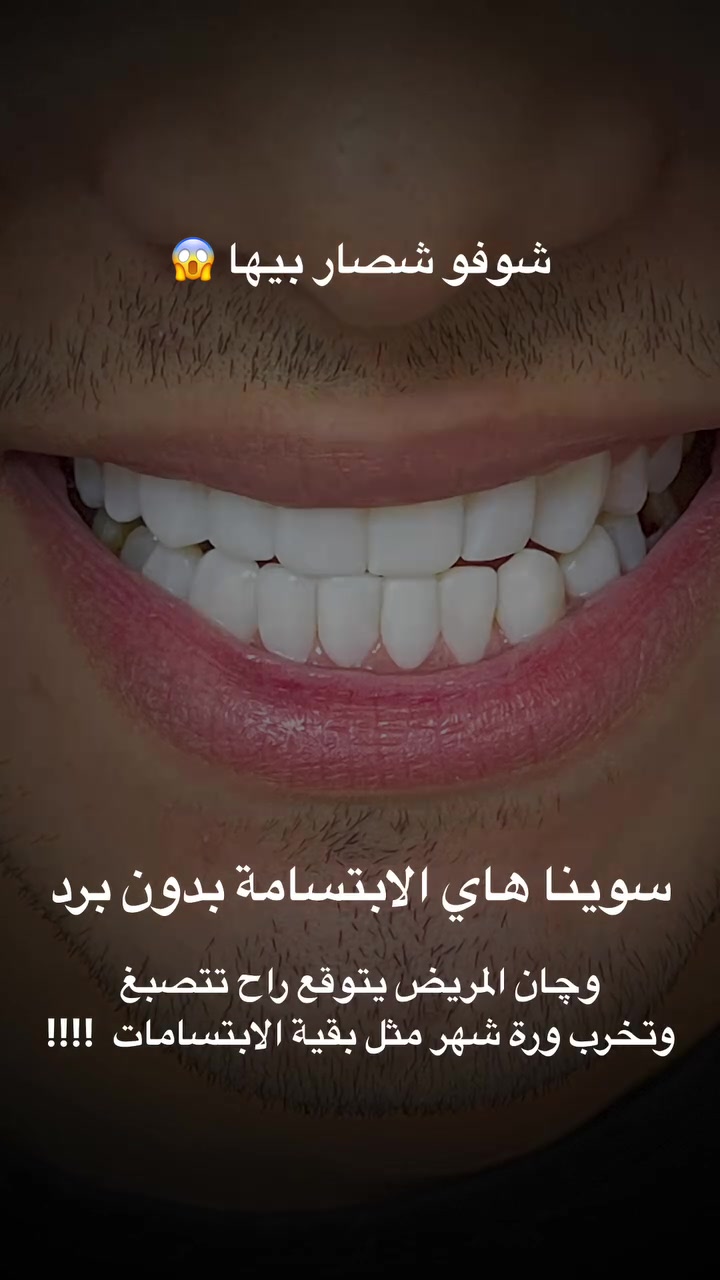 ⁨	✨ بدون برد الابتسامة محبوبة الجميع 😎
عنوانا بغداد / الحبيبية / قرب ساحة الحمزة 
للحجز : ***********⁩
