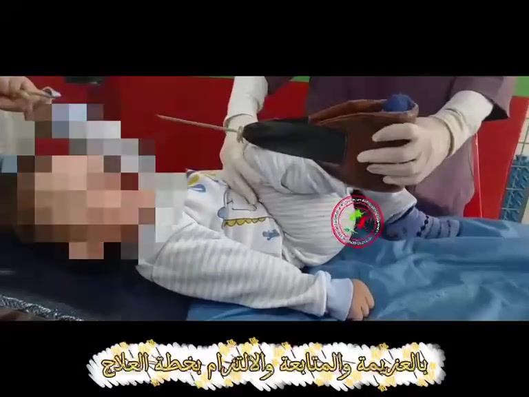 ولا تقنطو من رحمة 🌹🌹
الحمد لله الذي جعلنا سبب في شفاء هؤلاء المرضى 💪💪💪💪
القصه الأولى 
مع بطل من أبطال💪💪💪
 #عيادة #الموصل #للعلاج #الطبيعي بالزيوت والأعشاب
الطفل  وسام محمد   ♥️♥️♥️
من محافظة صلاح الدين 🌹🌹
كان الطفل يعاني من
 قصر بالاوتارفي الأطراف السفلى
الحمد لله استطعنا وخلال🌹🌹
 #ثلاثة اشهر @ان نرسم الفرحة♥️♥️❤️❤️❤️
على وجه والديه وان يخطو خطواته الأولى بثبات  وثقه 🚶🚶🚶
تحت اشراف خبير الاعشاب💪💪
أبو أبراهيم الزيزفون🌹🌹
  وابطال كادر عيادة الموصل للعلاج الطبيعي 🌹
حي البعث داخل فرع صيدلية بروتون🌹🌹
***********
@أبرز المعجبين@المتابعين

