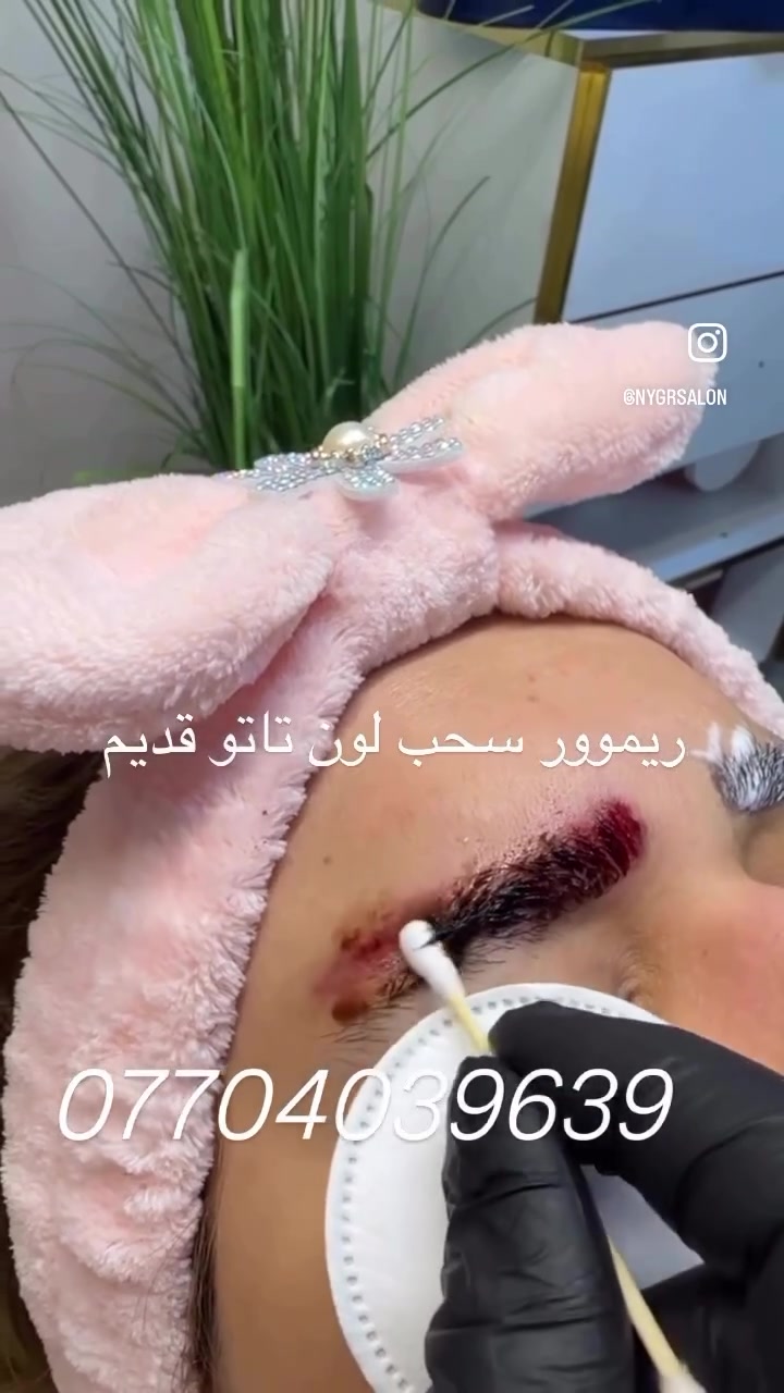 ريموور#سحب#لون تاتو#قديم  بدون اي اثار#***********😘🦋🦋
