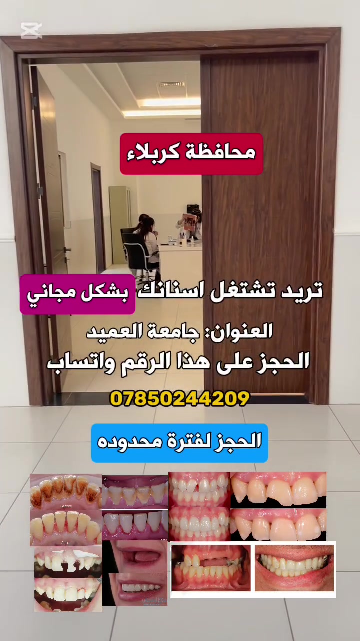 نقدم لكم كافة العلاجات تحت إشراف نخبة من أساتذة وأطباء الأسنان:
✨ الخدمات المتاحة مجاناً بالكامل:
🔹 تنظيف وتلميع الأسنان: إزالة التكلسات والترسبات القوية ورعاية اللثة.
🔹 الحشوات التجميلية والعادية: حشوات ضوئية تجميلية للأسنان الأمامية وحشوات خلفية.
🔹 علاج وجذور الأسنان: حشوات جذور للأسنان الأمامية.
🔹 القلع الجراحي والعادي: قلع الأسنان التالفة وبقايا الجذور.
🔹 تعويض الأسنان المفقودة: أطقم أسنان متحركة (جزئية أو كاملة للفكين) بأجود المواد.
🔹 طب أسنان الأطفال: حشوات، قلع، وتطبيق الفلورايد للوقاية من التسوس.
🔹 عيادة طب الفم: تشخيص وعلاج أمراض وفطريات الفم، وعلاج مشاكل وطقطقة مفصل الفك (TMJ).
🔹 الفحص والأشعة: تشخيص كامل للأسنان مع التقاط الأشعة مجاناً.
📍 العنوان: كربلاء -السعدية-خلف مول الحارث
📱 للحجز والاستفسار عبر الواتساب: ***********
⚠️ الأماكن والعدد محدود
  #طب اسنان
