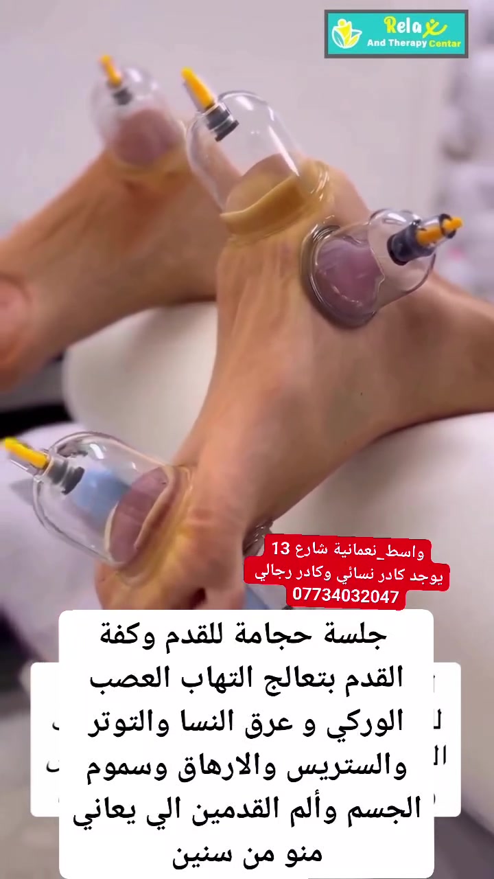 جلسة حجامة للقدم وكفة القدم بتعالج التهاب العصب الوركي و عرق النسا والتوتر والستريس والارهاق وسموم الجسم وألم القدمين الي يعاني منو من سنين
العنوان محافظة واسط قضاء النعمانية شارع 13 الفرع مقابل دكتور علاء ابو سونار 
يوجد كادر نسائي وكادر رجالي 
***********
#الحجامة_النسائية
#حجامة_نسائية
#حجامة_عرق_النسا
#عرق_النسا
#حجامة_كف_القدم
#حجامة_القدم
#الحجامة_الطبية
#الحجامة_العلاجية
#حجامة
#الحجامة_في_النعمانية
#حجامة_واسط
#حجامة_للنساء
#كادر_نسائي
#الجميع

