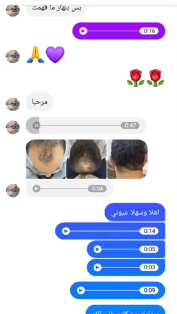 نتائج أولية • علاج تجميلي • اطلب دايركت
