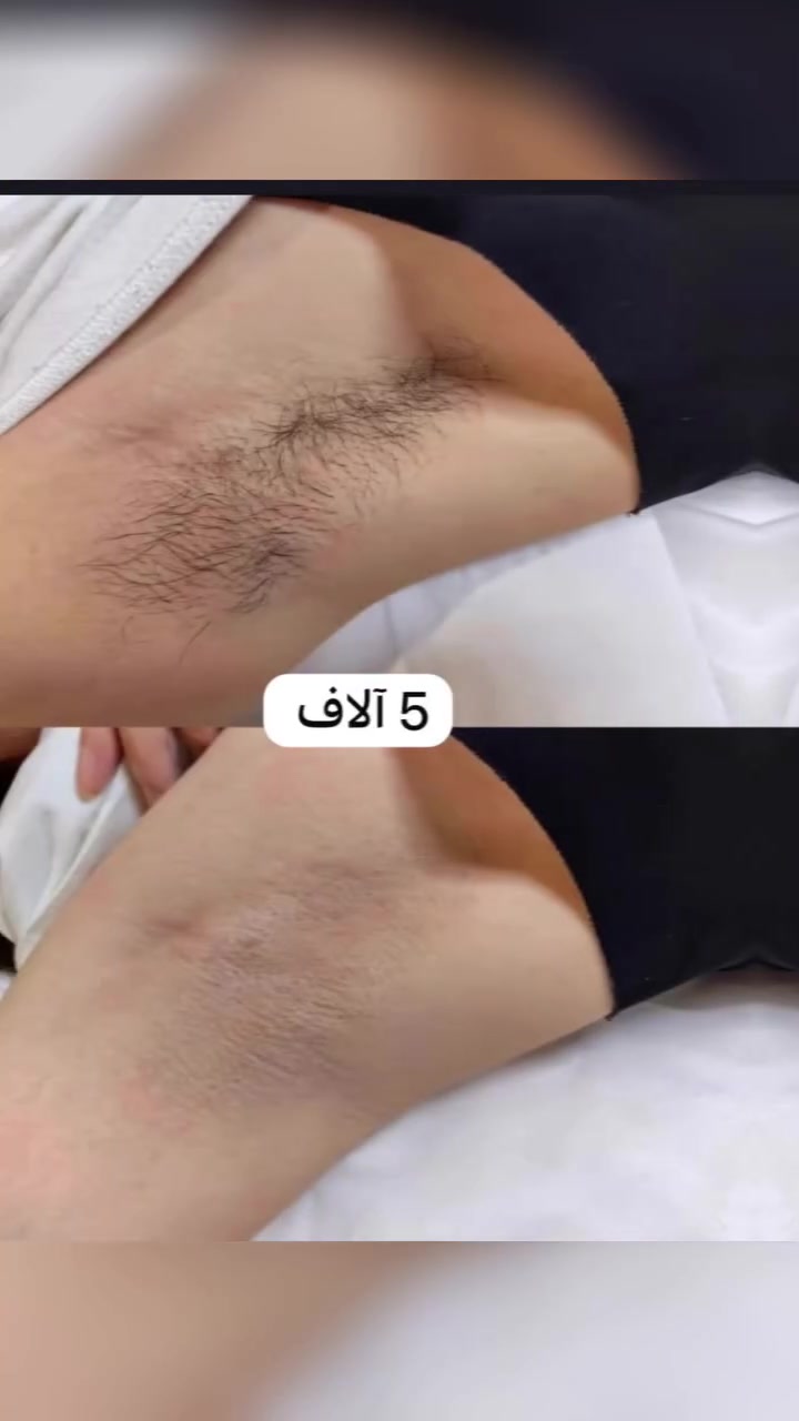 عروض صالون روشان عنوان الضباط خلف ورشه ابو ريان المصلح الخدمي القريب ع سريع ***********
