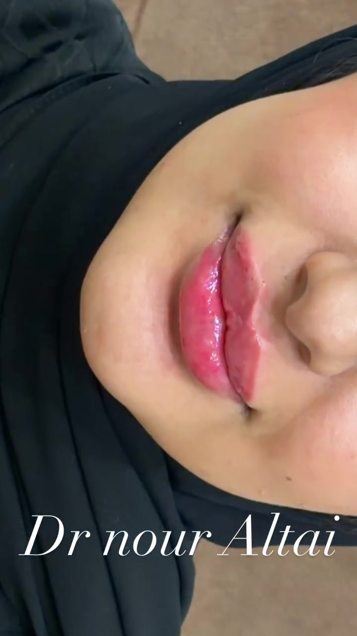 اني دكتوره تجميل هذا شغلي بالفلر والنظاره وهذا رقمي ***********
