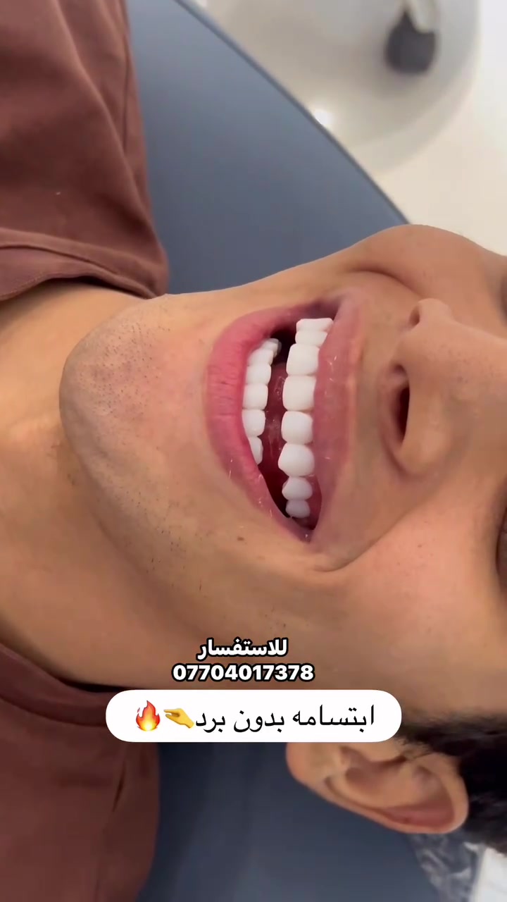 لا توجد تفاصيل
