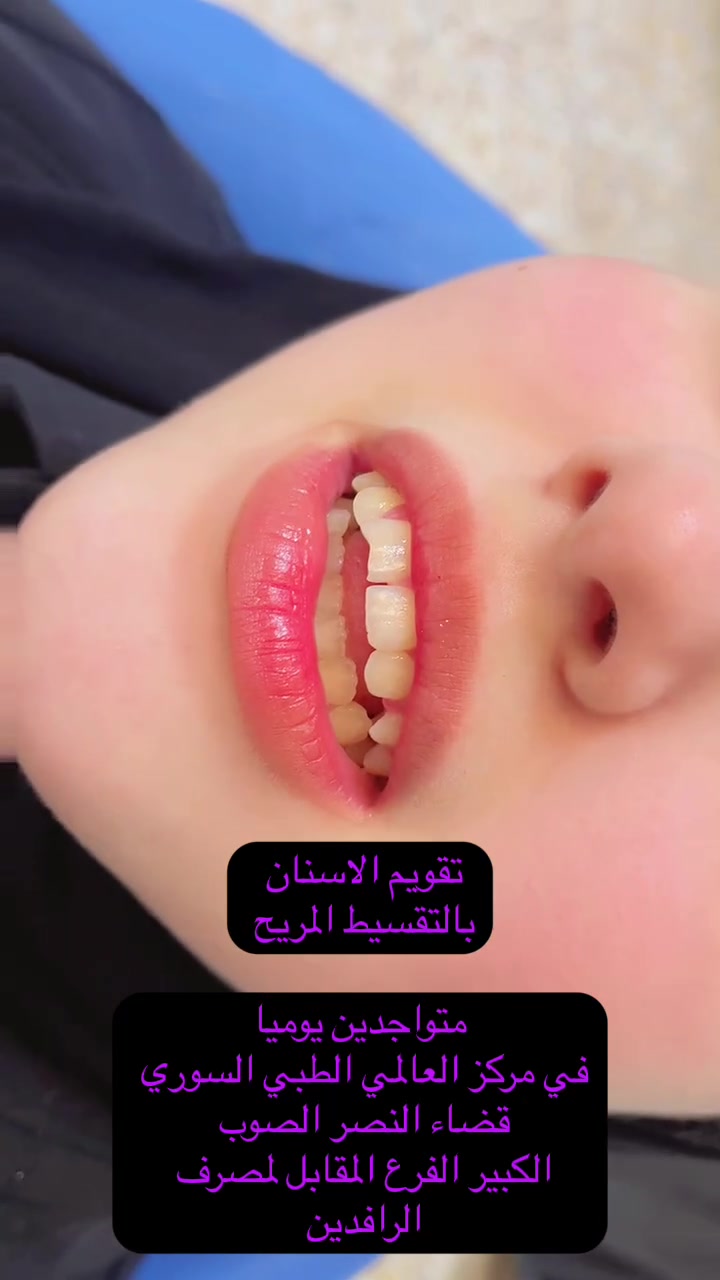 نستقبلكم يوميًا بكل حب واهتمام في مركزنا الطبي الخيري 🤍

نوفر لكم مجموعة من العيادات التخصصية التي تهتم بصحتكم وتلبي احتياجاتكم الطبية، وتشمل عيادات الأسنان، النسائية، الباطنية والقلبية، وقسم الطوارئ والمختبر

نحرص دائمًا على توفير رعاية طبية متميزة، وبيئة مريحة، واهتمام حقيقي بكل مراجع 🌿

صحتكم تهمنا، وراحتكم أولويتنا 🤍
أهلًا وسهلًا بكم يوميًا في مركزنا.
***********
