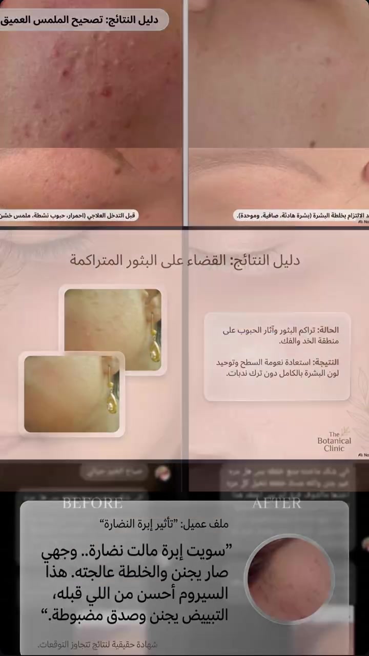 ‎بنات اقسم بالقرآن  وع كل حرف  اكوله وان شاء الله  
‎بعافيتي وبصحتي ا🤩ذا اغشكم بنات اسوي زيت للشباب وللببنات شعر يفور فورررررر عليه انسي بعد شي حرك من صبغ انسي بعد  قصير انسي شي تساقط لي دتطلب علبة دترجع نوب تاخذ بنات يموووت انصحكم بي  ثقو بالله ددمرون شعركم بالمنتجات بنات هذا جربو وادعولي واني بيدي اسوي الخلطة وتوصيل مجاني كذلك واسوي خلطه للوجه اكسر بيها ابر تبيض ونضارة وشد الله شاهد على كلامي

نص مكتوب في الصور:
- لأنك تستاهلين الأفضل دائماً
- خلطة الكولاجين الذهبية لنضارة وتفتيح البشرة
- بشرة أكثر شباباً .. وإشراقة كل يوم
- فوائدها:
- تمنح البشرة نضارة وإشراقة واضحة
- تساعد على تفتيح وتوحيد لون البشرة
- تقلل من ظهور الخطوط والتجاعيد
- ترطب البشرة وتمنحها نعومة ولمعان
- غنية بالكولاجين لدعم مرونة البشرة ومظهرها الممتلئ
- تغذي البشرة وتساعد على حمايتها وتجديدها
- كولاجين
- فيتامينات
- مكونات طبيعية
- ترطيب عميق
- خلي بشرتك أجمل وأكثر حيوية مع هالطخلطة
- جمال طبيعي بنتيجة مضمونة
- للطلب والاستفسار
- ***********
