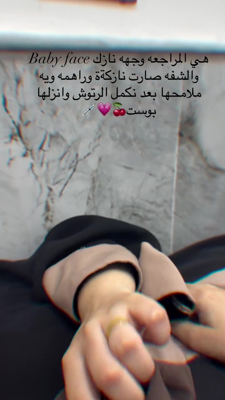 هواي دزيتولي على عروض
فرحة الزهرة وموسم اعراس وحفلات ونريد نفرح تدللون

بعد مانزلت ان توفرت ماشاءالله المسجات متوقفت💗 بس هالمرة الكمية تكفي الكل ان شاءالله وكلكم تلحكون تسوون تغييرات حلوة والعروض مستمره بلشت من اليوم 

 خلص العروض صارت جاهزة 
ومراح تتكرر ابداً هيج عروض لان بيها جلسات فري 🎁 تستفادون منها كلش هواي خصوصا الي يحتاجون عدة جلسات 🎁💗

بس لخاطرر تفرحون بمناسباتكم وتسوون كلشي عاجبكم

والمهم المواد مسجلة ومفحوصه من وزارة الصحة 
العروض تكدرون تراسلونا على الدايركت او على الواتساب مسج
***********

العنوان المسيب شارع البلدية تواجدي يكون ايام معينة بالمسيب وباقي الايام كلها بغداد لذلك يرجى الحجز قبل الحضور 💗🎁

