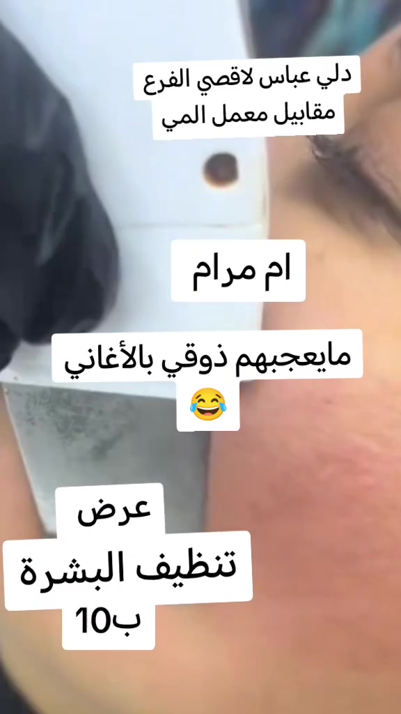 #اشارة حفافه ب5 الاقصي  الفرع مقابيل معمل المي
