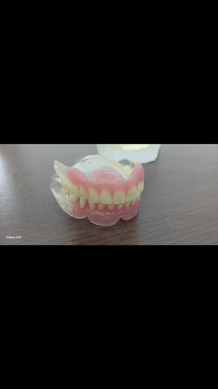 🦷✨ ابتسامة جديدة تبدأ من هنا!
عمل طقم أسنان علوي وسفلي + جسر زاركون بأحدث التقنيات وبإشراف وخبرة عيادة ومختبر الدكتور مصطفى خضير لزراعة وتجميل الأسنان.
📍 بغداد – مدينة الصدر – شارع الفلاح – قطاع ٢٥
📞 للحجز والاستفسار: ***********
✨ جودة عالية • دقة بالعمل • ابتسامة طبيعية
#اسنان #زراعة_الاسنان #تجميل_الاسنان #العراق #بغداد
