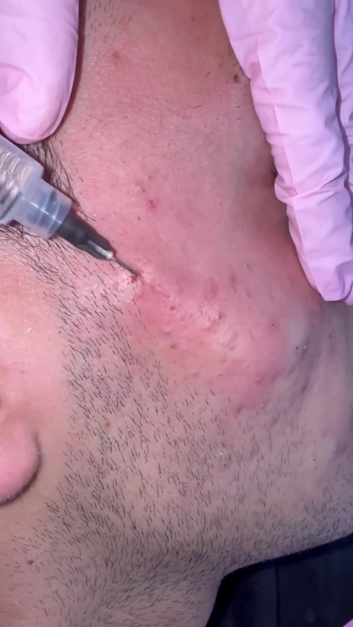 🖤 MEN’S CARE | عناية متكاملة للرجل 🖤

✨ تقطيع الألياف
✨ بلازما PRP للرجال

لإطلالة أكثر نضارة وحيوية…
وعناية احترافية بإشراف مختصين 🤍

👨🏻‍⚕️ عيادة حور
خدمات تجميلية وعناية متخصصة للرجال والنساء

📍 بغداد – الحسينية | السوق الكبير
مقابل مطعم السواعد

📞 ***********
للحجز والاستفسار
