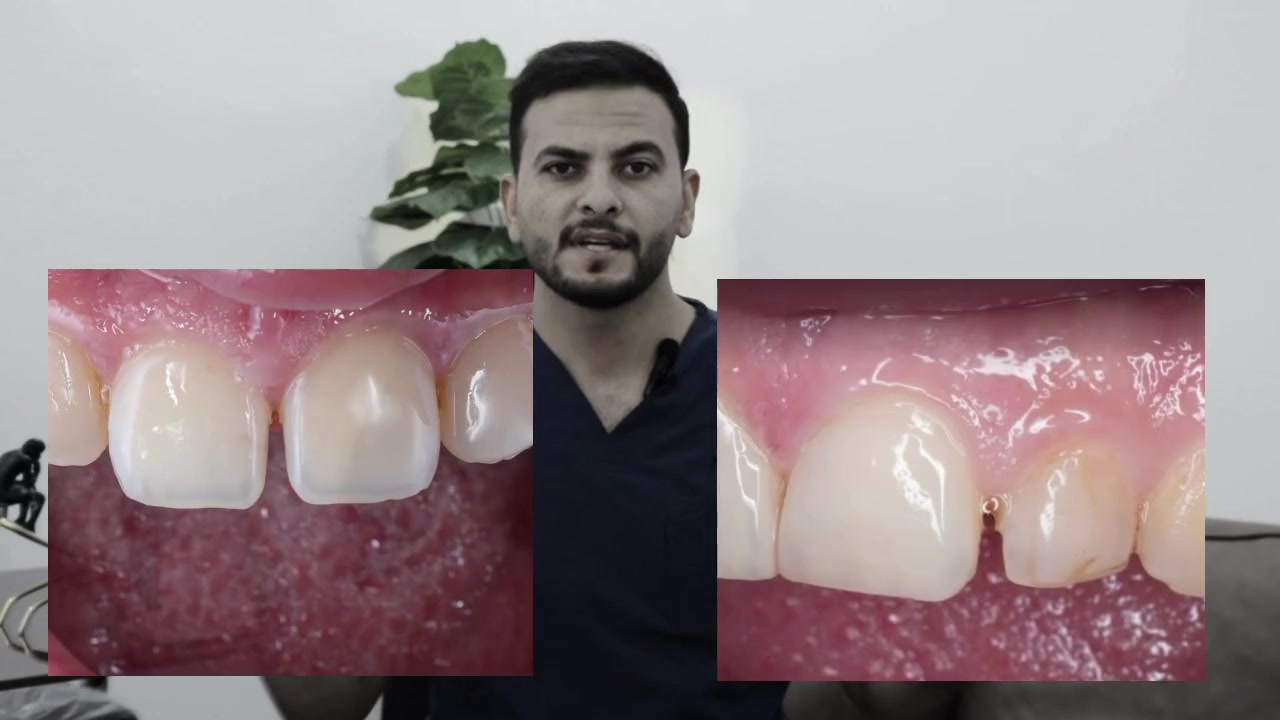 الدكتور
محمد حميد ( بكالوريوس طب وجراحه الفم والأسنان) 
للحجز والاستفسار ***********
حي الجهاد الضباط
