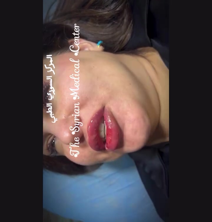 المحموديه • فلر • شفه