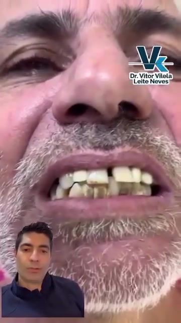 السلام عليكم 
الي عنده هيج اسنان بيهم حركه ويحتاج قلع 
تواصلوا معاي واتساب ***********

