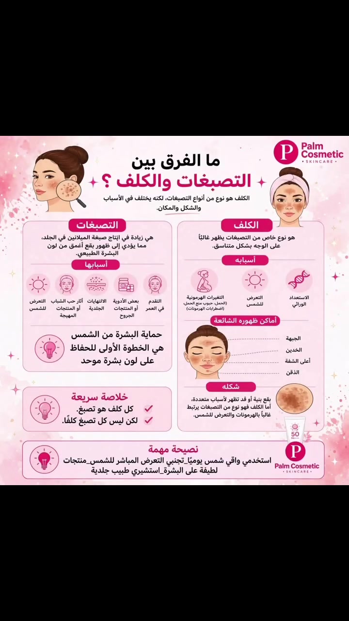 تعانين من بقع غامقة وما تعرفين إذا هو كلف لو تصبغ؟ 🤔
خلي أفهمج الفرق بسرعة حتى تعرفين تعالجيه صح!

✨ الفرق باختصار:
🔹 التصبغات: زيادة ميلانين بسبب الشمس، آثار الحبوب، التهاب، أدوية، أو تقدم العمر. تظهر بأماكن متفرقة وبأشكال مختلفة.

🔹 الكلف: نوع خاص من التصبغات، يجي غالباً بشكل متناسق على الوجه بسبب:
- التغيرات الهرمونية (حمل، حبوب منع حمل)
- التعرض للشمس
- الاستعداد الوراثي

📍 أماكن الكلف المفضلة: الجبهة، الخدين، فوق الشفة، والذقن.

💡 الخلاصة اللي لازم تحفظيها:
✔️ كل كلف هو تصبغ
❌ لكن مو كل تصبغ هو كلف!

والأهم من هذا كله؟ 👇
حماية البشرة من الشمس هي الخطوة الأولى للحفاظ على لون موحد!

نصيحة Palm الذهبية 💗
استخدمي واقي شمس 50+ يومياً حتى بالبيت، وتجنبي الشمس المباشرة، واختاري منتجات لطيفة على بشرتج. واذا الكلف عنيد؟ لازم استشارة طبيب جلدية + روتين Palm للتفتيح.

تعانين من كلف لو تصبغات؟ اكتبيلي بالتعليقات "كلف" أو "تصبغ" وأنا أرشحلج الروتين المناسب لبشرتج مجاناً! 👇
