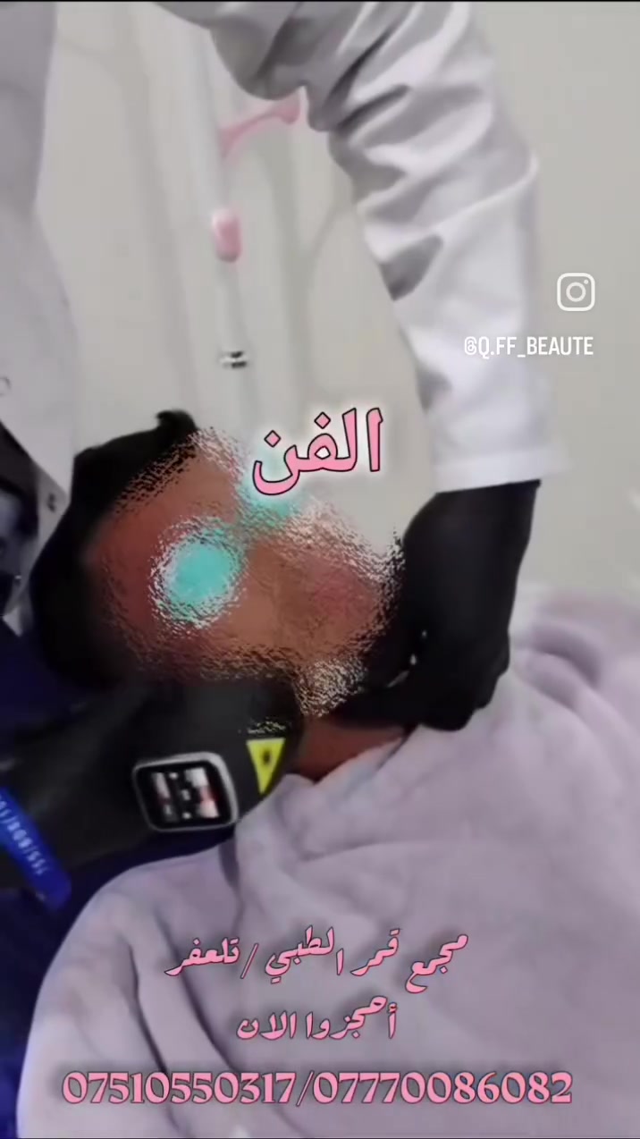 قسم الرجال ؛ جلسات إزالة الشعر بالليزر تُدار بواسطة كادر رجال مختص .
لتواصل 
***********
***********
