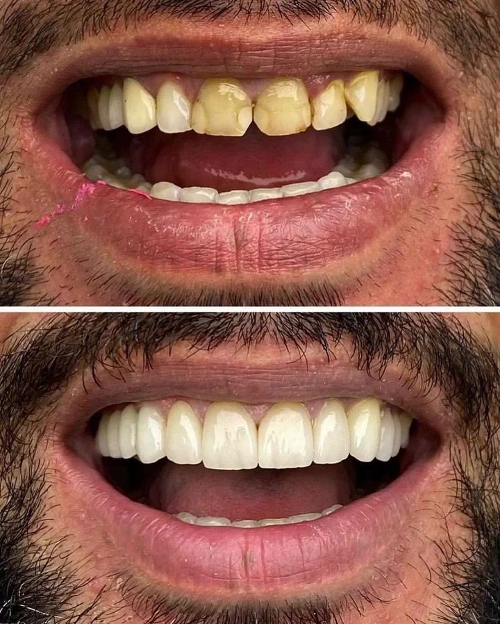 مركز الفردوس • تجميل أسنان • القرنة