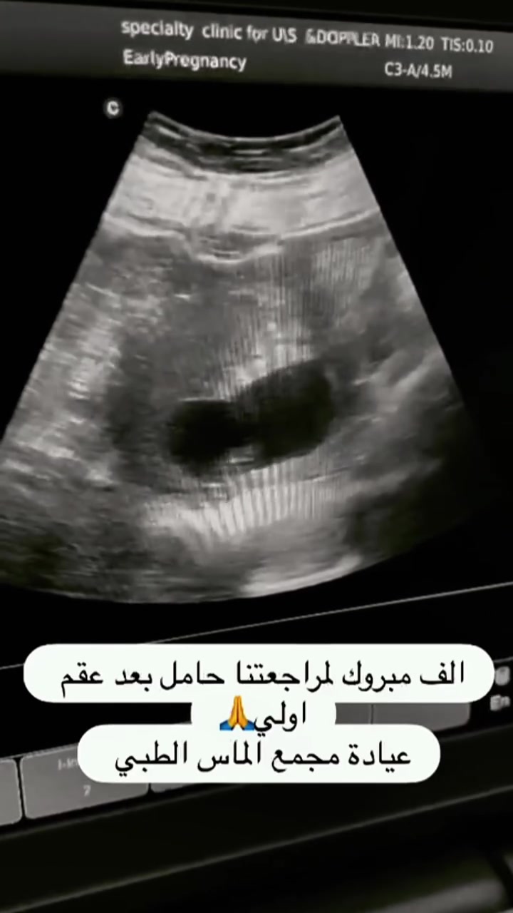 ❤️ تم توفير جهاز تخطيط القلب الحديث ECG ❤️
📢 ❤️ إعلان هام _ تخفيض وعروض على الكشفيه والفحوصات والعلاج ❤️  مجمع الماس الطبي ❤️
عياده المفاصل والروماتزم وامراض الباطنيه والقلبيه والاطفال 
العياده النسائيه والسونار ( موجودين كل ايام الاسبوع ) 
جهاز تخطيط القلب ECG 
للحجز والاستفسار.     ***********
بغداد - گميره / قرب جامع ابو الزهراء / مجاور جملة ايوب - فوق صيدليه طوق الماس
