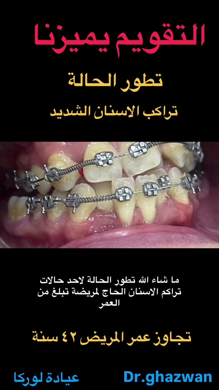 لا توجد تفاصيل

