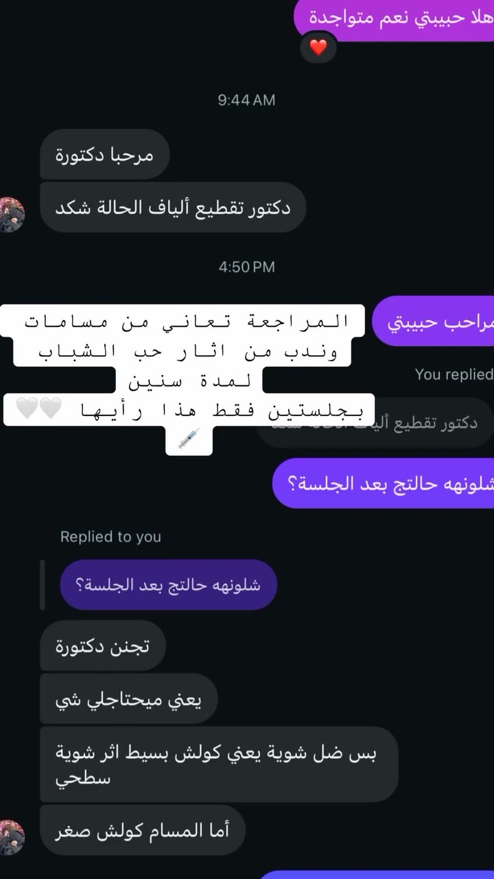 عروض شهر التاسع
مراجعاتي  الحلوات ورأيهم صوت وصوره ماشاءالله الفرق ديشوفو من اول الجلسات لان الاختيار يكون مو عشوائي كل مراجعة نختارلها مكس او ابرة خاصة لحالتها💉💗💗👏 وهو هذا الشغل الصح الي يخليكم تشوفون فرق من الجلسة الاولى 💉🍓

بخصوص العروض مراح تتكرر بعد ابداً لان اقوى عروض سويناهه 

خلال شهر التاسع واقبالكم عليه جداً عالي 💉👏

بخصوص كل المواد الجديدة الي تنزل داخل العياده تكدرون تتابعون صفحة الانستكرام 

https://www.instagram.com/p/DbWWdUhsNAt/?stkn=Z2EwenVjcm5rOXFu

او صفحتنا على الفيسبوك DrRusl Alrubaie

او مراسلتنا واتساب مسج فقط ***********
