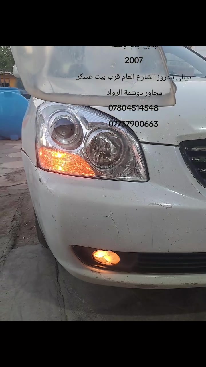 ديالى بلدروز • زرع عدسات • ضمان