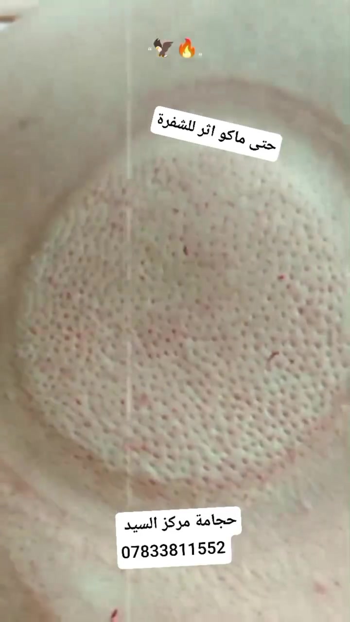 لسنا الوحيدين لكننا الافضل
مركز السيد للحجامة والمساج 

***********

ذي قار شطرة شارع دبي 

بادارة التقني سيد علي الجابري
