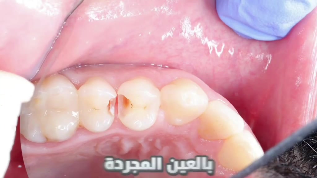 احجز استشارة • ابتسامة • تواصل ويانا