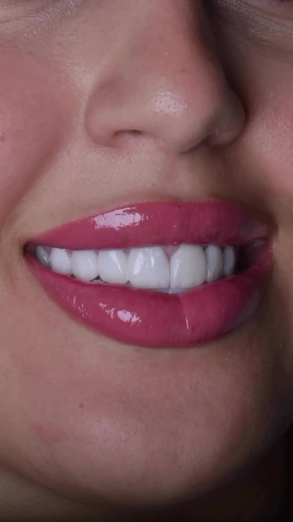 🦷✨ ابتسامة أجمل تبدأ من هنا ✨🦷

لأن جمال ابتسامتك ينعكس على ثقتك بنفسك، نقدم لكم أفضل خدمات طب الأسنان بأحدث التقنيات وأعلى معايير الجودة.

العنوان / الزبير /شارع الرشيدية/ مجاور الرشيدية سنتر

للحجز والاستفسار ***********📍 
💙 ابتسامتك… مسؤوليتنا، ورضاكِ غايتنا. 🌷#تقويم_اسنان #ابتسامة_هوليود #زراعة_اسنان #ابتسامة_المشاهير #مراكز_الشركة_الطبية_العالمية

