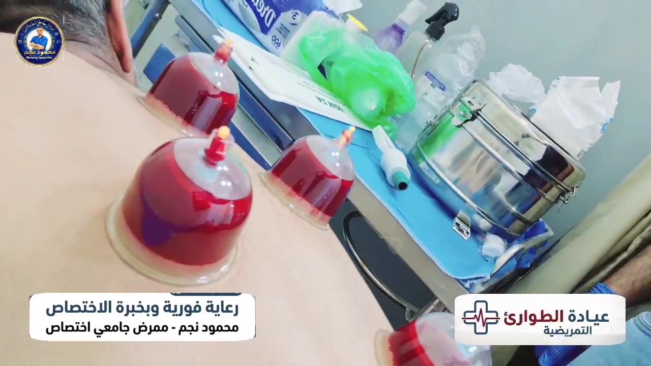 الحجامة وفق أعلى معايير التعقيم ومكافحة العدوى
​رعاية صحية فورية وبخبرة الاختصاص 🩵

​صحتكم أمانتنا ..
نقدم لكم أفضل الخدمات التمريضية والطارئة بإشراف كادر متخصص حاصل على شهادة عليا بالتمريض -  الدبلوم العالي في تخصص تمريض الحالات الحرجة.

​💉 أبرز خدماتنا :

🧑‍⚕️ الإسعافات الأولية والطوارئ : التعامل مع أزمات التنفس ، إغماءات السكر والضغط ، والصدمات التحسسية.

🧑‍⚕️ الجروح والحروق : التضميد المعقم ، خياطة وإزالة الخيوط ، تجبيس الكسور وإزالة التجبيس ، العناية بقرح الفراش والقدم السكري.

🧑‍⚕️ المغذيات والحقن : ربط الكانيولا للحالات الصعبة وإعطاء العلاجات بدقة وفق ما يقرره الطبيب.

🧑‍⚕️ تركيب الصوندات : البولية (الفولي) والمعدية (أنبوب التغذية).

🧑‍⚕️ الفحوصات والمتابعة : تخطيط القلب (ECG) ، فحص الضغط والسكر والأوكسجين ، فحص الأذن ، والخدمات التمريضية المنزلية.

🧑‍⚕️ الحجامة الطبية : وفق أعلى معايير التعقيم ومكافحة العدوى.

​📍 العنوان : بعقوبة - شارع حولي التحرير - مقابل ماركت المصطفى - قرب جامع عمر بن عبد العزيز

⏰ ساعات العمل : من 3:00 عصراً حتى 12:00 ليلاً.

📞 واتساب/تواصل: ***********
