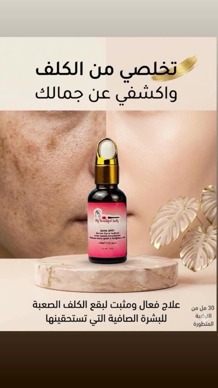 للتواصل وتساب ***********#متابعه #فلو #فولومي #تتفاعل # سيروم# فولومي
