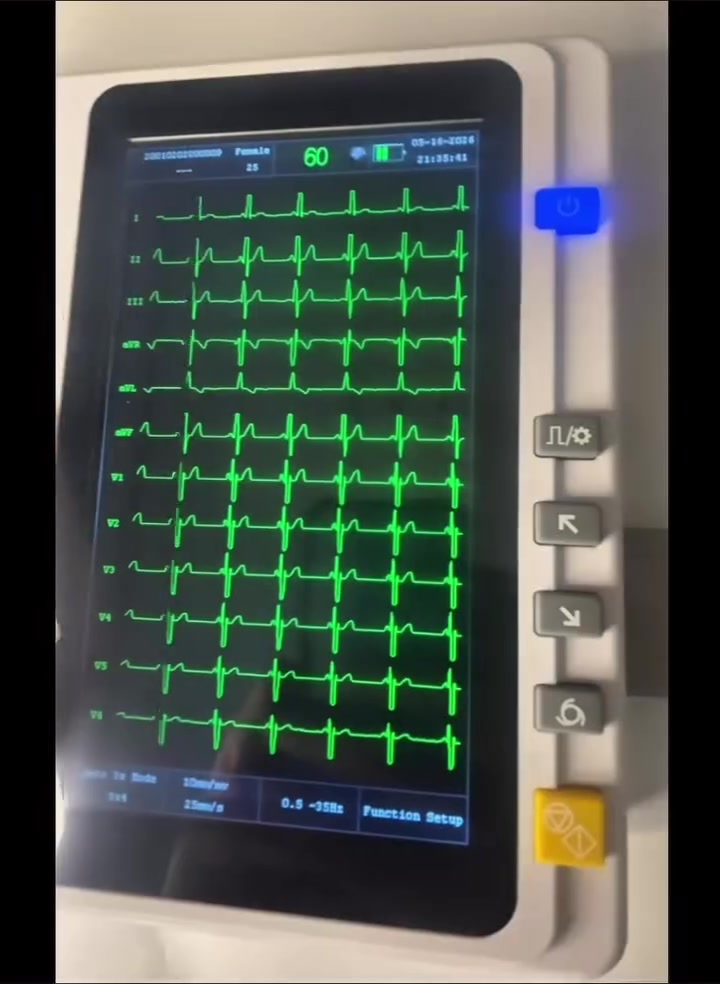 متوفر جهاز الـ….
ECG 3 channale
شاشة العرض تعرض 12 Channale

طباعة 3 channale
يمتاز الجهاز بدقة في القراءة 

ضمان لمدة سنة كاملة من تاريخ الشراء

للاستفسار التواصل خاص 

او وات ساب ***********
