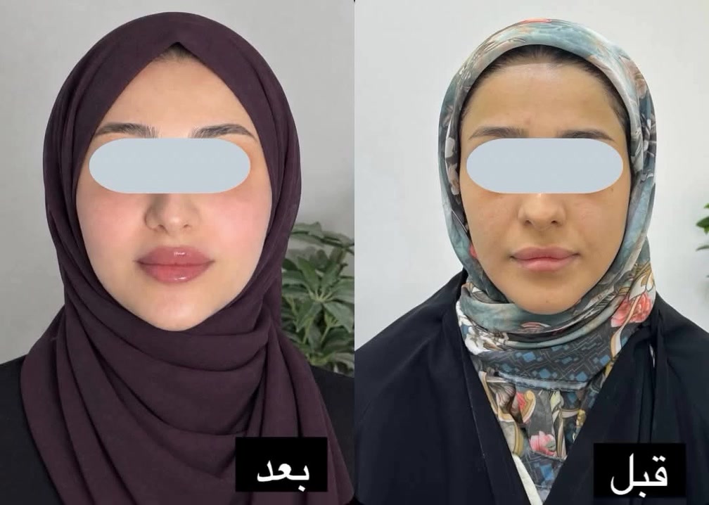 صالون • تجميل • بدون تفاصيل