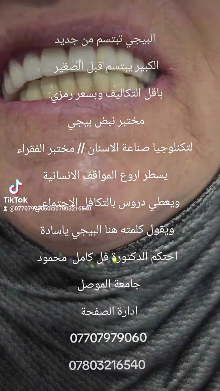 البيجي تبتسم من جديد 
الكبير يبتسم قبل الصغير 
[[((باقل التكاليف وبسعر رمزي))]]
مختبر نبض بيجي لتكنلوجيا صناعة الاسنان 
مختبر الفقراء // يسطر اروع المواقف الانسانيا ويعطي دروس بالتكافل الاجتماعي ويقول كلمته 
هنا البيجي ياسادة 
اختكم الدكتورة رفل كامل محمود 
ادارة الصفحة.
***********
***********
