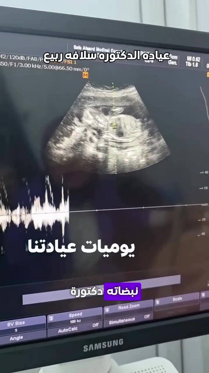 أخصائية نسائية • عقم • بسماية