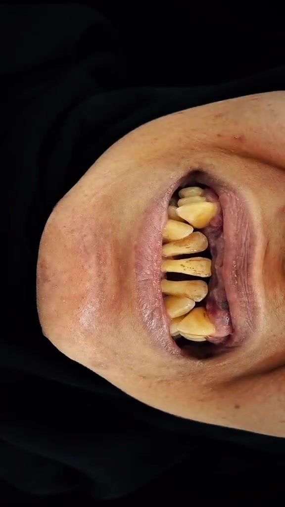 🦷✨ ابتسامة أجمل تبدأ من هنا ✨🦷

لأن جمال ابتسامتك ينعكس على ثقتك بنفسك، نقدم لكم أفضل خدمات طب الأسنان بأحدث التقنيات وأعلى معايير الجودة.

📍 مركز سما الزبير التخصصي لطب الأسنان
الزبير – محلة الشمال – شارع الشنقيطي – قرب سنتر زهير

📞 للحجز والاستفسار:
***********

💙 ابتسامتك… مسؤوليتنا، ورضاكِ غايتنا. 🌷
