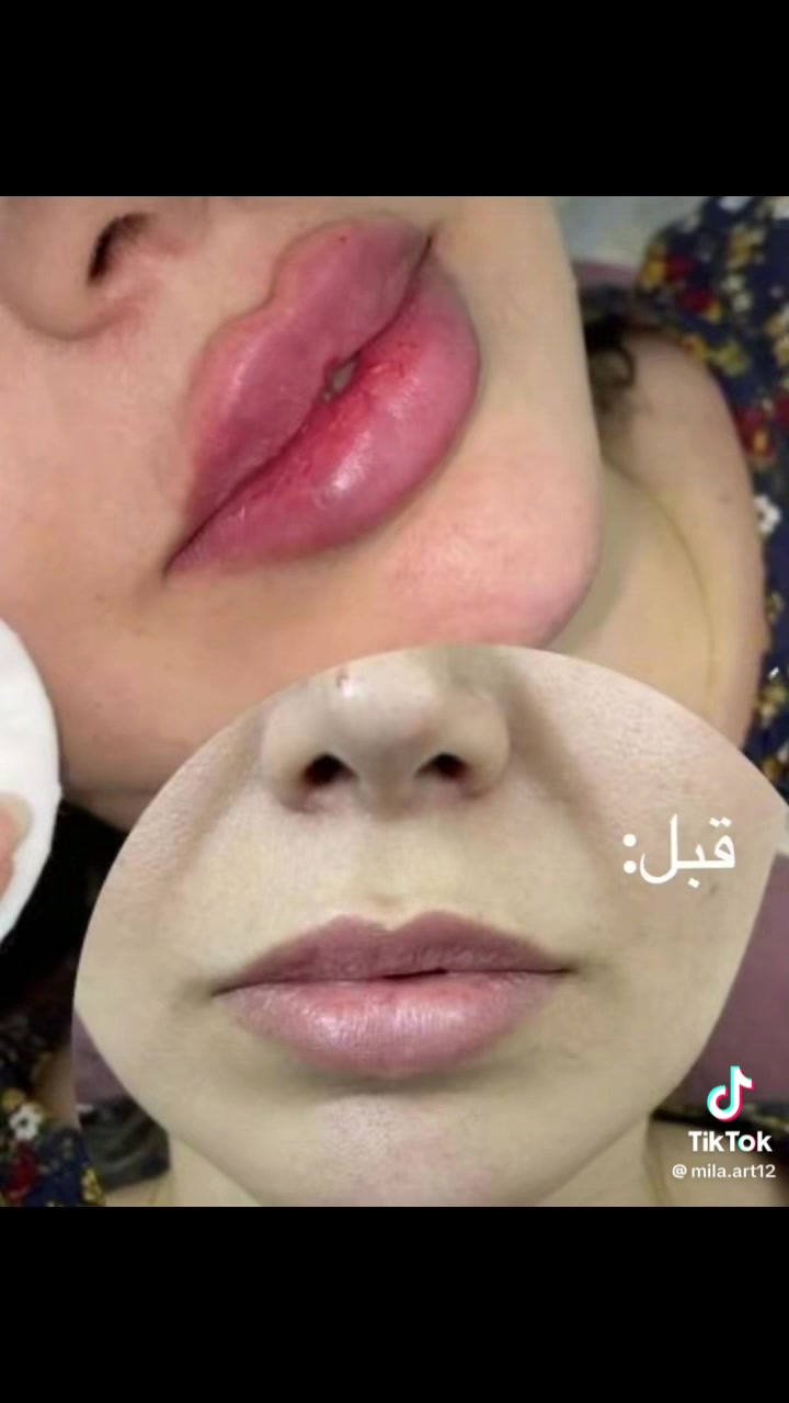 اهلا وسهلا جميلتنا عروض سبوت يرحب بيكم مستمره للحجز الاتصال على الارقام التاليه***********

