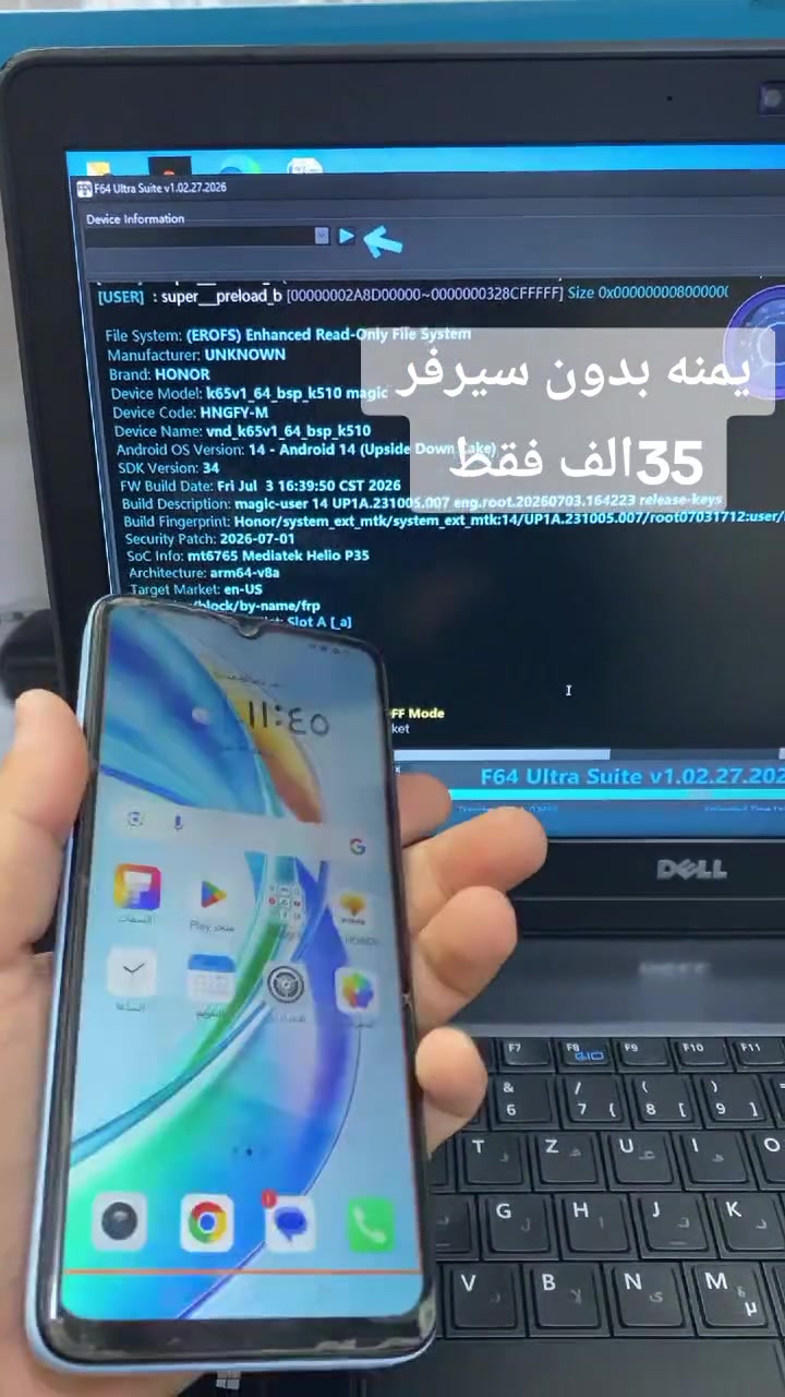 😱 تتوقع هذا الجهاز فتحه يكلف 75 ألف دينار؟

اليوم إجانا جهاز HONOR X5b Plus يحتاج فتح، وبالسيرفر تكلفة فتحه 75 ألف دينار!

بس المفاجأة وين؟ 🔥  
بالمركز الاحترافي للموبايل نفتحه إلك بـ 35 ألف دينار فقط!

إي نعم… 35 ألف بدل 75 ألف!  
يعني وفّرنا عليك 40 ألف دينار 💰

عندك نفس الجهاز ونفس المشكلة؟  
لا تستعجل وتدفع 75 ألف…

📱 المركز الاحترافي للموبايل  
الحل موجود… والسعر راح يفاجئك! 🔥
