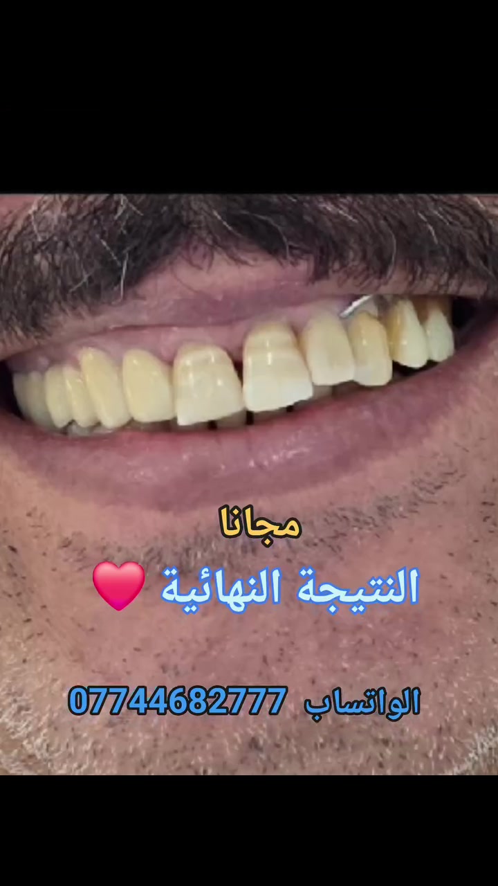 مجاني • عيادات جامعة العميد • علاج اسنان